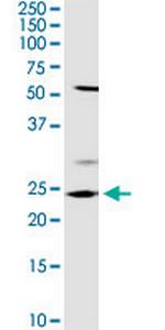 OTUB2 Polyclonal Antibody, MaxPab™