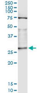 OTUB2 Monoclonal Antibody (2E7)