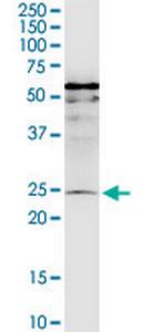 MIS12 Monoclonal Antibody (1G3)