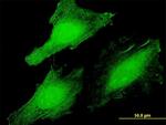 CLUHP3 Polyclonal Antibody, MaxPab™
