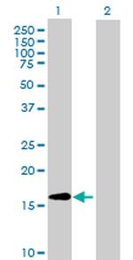 CLUHP3 Antibody in Western Blot (WB)