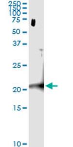C22ORF18 Antibody in Immunoprecipitation (IP)