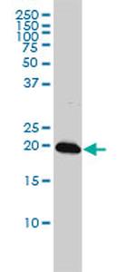 C22ORF18 Antibody in Western Blot (WB)