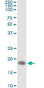 AHNAK Antibody in Immunoprecipitation (IP)