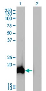 AHNAK Monoclonal Antibody (3G7)