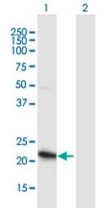ZNF655 Polyclonal Antibody, MaxPab™
