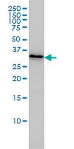 PDCL3 Monoclonal Antibody (1F10)
