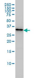 PDCL3 Antibody in Western Blot (WB)