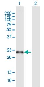 C19ORF50 Antibody in Western Blot (WB)