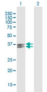 PVRIG Polyclonal Antibody, MaxPab™
