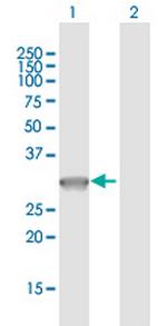 PVRIG Polyclonal Antibody, MaxPab™