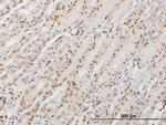 DDX54 Monoclonal Antibody (2E4)