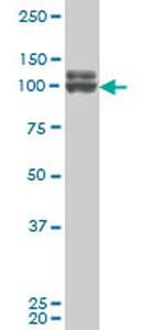 DDX54 Antibody in Western Blot (WB)