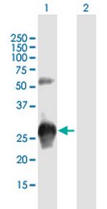 KCTD15 Antibody in Western Blot (WB)