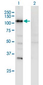 SECISBP2 Monoclonal Antibody (3A7)