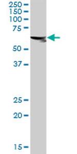 ASPSCR1 Antibody in Western Blot (WB)