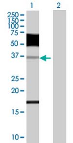 ZNF426 Polyclonal Antibody, MaxPab™