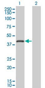 RNF26 Monoclonal Antibody (5B9)