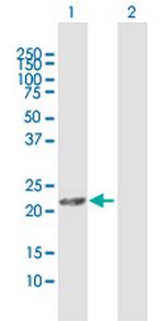 DHRS11 Polyclonal Antibody, MaxPab™