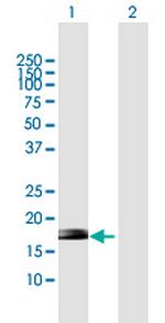 ZNF576 Polyclonal Antibody, MaxPab™
