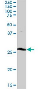 THTPA Polyclonal Antibody, MaxPab™