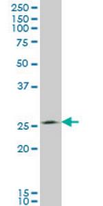 THTPA Monoclonal Antibody (3F6)