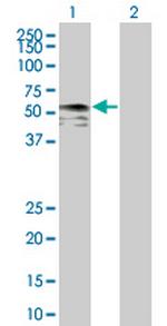 IRX6 Antibody in Western Blot (WB)
