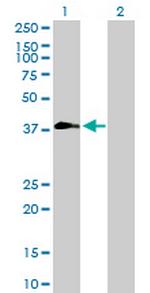 ZNF557 Antibody in Western Blot (WB)