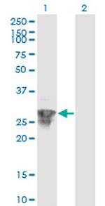 C1orf89 Antibody in Western Blot (WB)