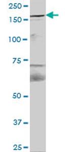 FYCO1 Antibody in Western Blot (WB)
