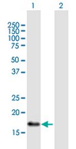 TNFAIP8L2 Polyclonal Antibody, MaxPab™