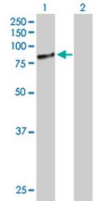 RPAP3 Antibody in Western Blot (WB)