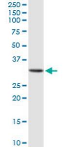 GALNT12 Polyclonal Antibody, MaxPab™