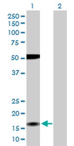 ZMAT4 Polyclonal Antibody, MaxPab™