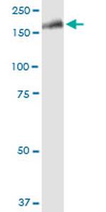 LRRK1 Antibody in Western Blot (WB)