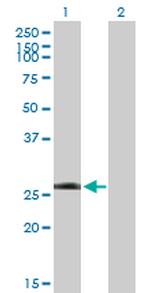 LRRK1 Polyclonal Antibody, MaxPab™