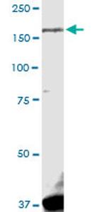 LRRK1 Antibody in Western Blot (WB)