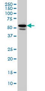 TBL1XR1 Monoclonal Antibody (3G7)