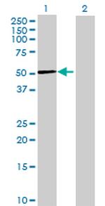 ZNF659 Antibody in Western Blot (WB)