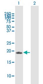 ZFAND1 Polyclonal Antibody, MaxPab™