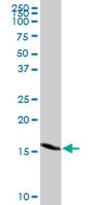 GEMIN7 Antibody in Western Blot (WB)
