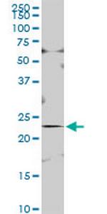 ISOC2 Polyclonal Antibody, MaxPab™