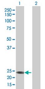 FLJ22655 Antibody in Western Blot (WB)
