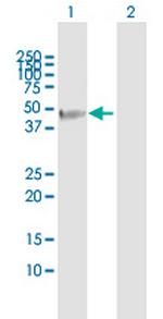 FBXO31 Antibody in Western Blot (WB)