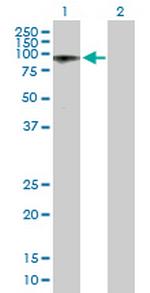 ALS2CR8 Antibody in Western Blot (WB)