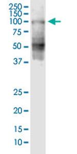 SHCBP1 Monoclonal Antibody (1G8)