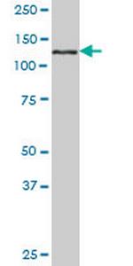 EHMT1 Monoclonal Antibody (3C5)