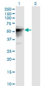 TLE6 Monoclonal Antibody (2E4)
