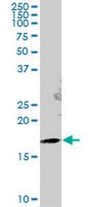 GEMIN6 Polyclonal Antibody, MaxPab™