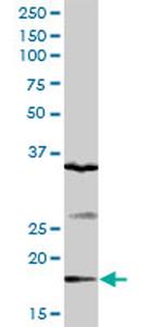 GEMIN6 Antibody in Western Blot (WB)